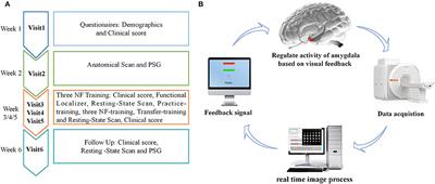 Improved Regional Homogeneity in Chronic Insomnia Disorder After Amygdala-Based Real-Time fMRI Neurofeedback Training